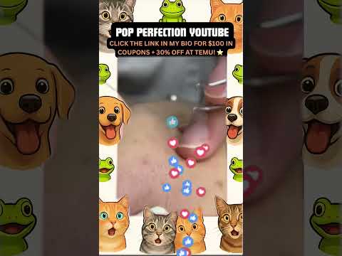 Wow! #pimpleremoval #pimple #pimples #shortsfeed #shortvideo #shorts #short #youtube #youtubeshorts