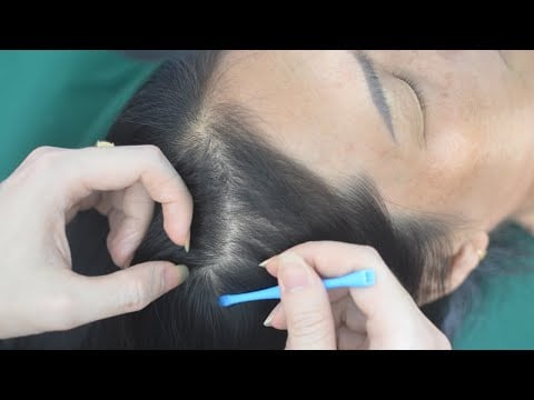 ASMR Sounds Of Head Scratching And Tingling Hair Combing For Anxiety Relief