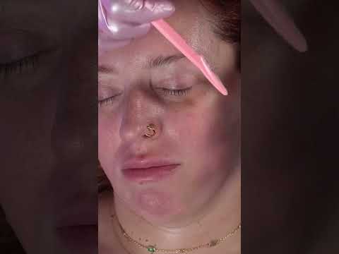 Gentle Dermaplaning on My Jawline #shorts