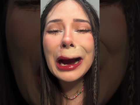 Granitos antes vs ahora jajajaj #asmr #grabos #antesvsahora #grano #stickers