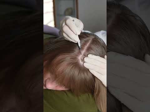 Asmr scalp 💆🏻‍♀️ #asmr #asmrsounds #asmrvideo #relax #relaxing #satisfying #hair #tingles #sleep