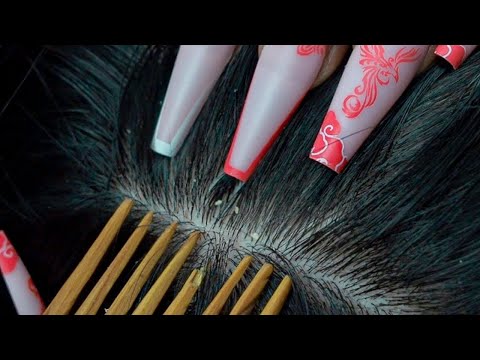 ASMR Rare and Super Attentive Scalp Check -Up 🙇🏻‍♂️