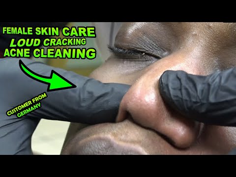 FEMALE ACNE OIL CLEANING & SKIN CARE & NECK CRACKING & Asmr face, neck, palm, leg, ear, back massage