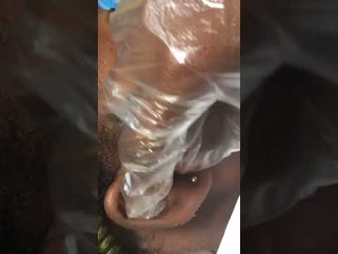 Very attentive ear nitpicking Asmr #satisfying #earcleaning #oddlysatisfying