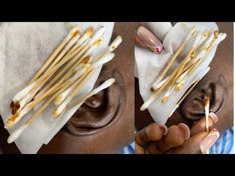 MOST REALISTIC EAR CLEANING ASMR FOR THOSE WHO WANT TO SLEEP