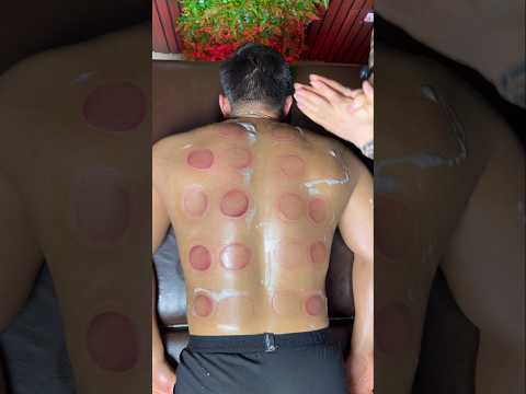 pizza cupping ASMR 🍕😍#cupping #asmr #cuppingtherapy #asmrsounds #shorts #explore #viral