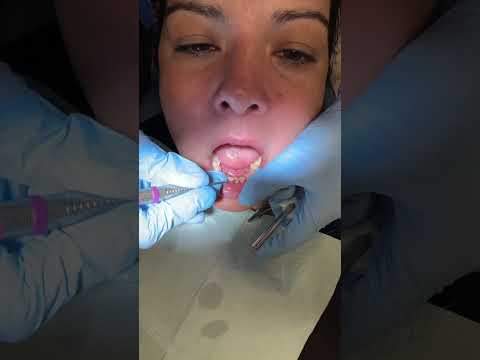ASMR Dental Cleaning | Calm Dentist Visit for Deep Relaxation