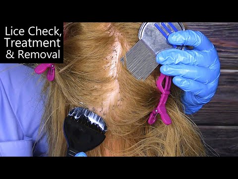 ASMR Lice Check, Treatment and Removal | Lice Comb, Rat Tail Comb, Gloves, Whisper | Medical RP