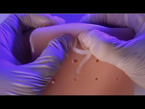 ASMR | O VÍDEO MAIS SATISFATÓRIO DE EXTRAÇÃO DE CRAVOS QUE VOCÊ VAI VER HOJE