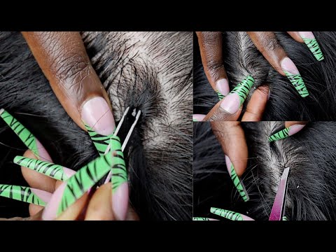 ASMR for Those Who Want To Sleep Soundly ~ pulling whiteheads from hair ~ soft whispers ☁️