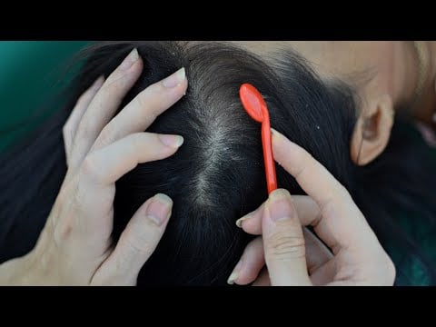 ASMR Scalp Scratching ~ Scalp Massage Relaxing For Headache Relief ( Asmr No Talking )