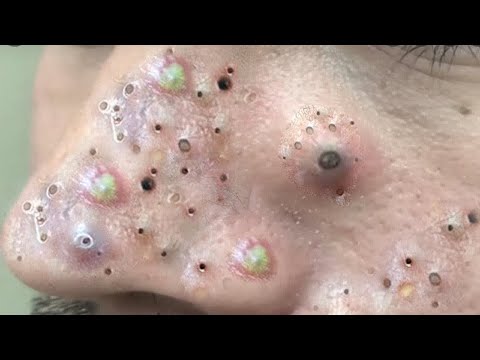 ‎تلميع وتنظيف الجلد الطبيعي المدور