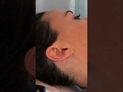 ASMR Ear Exam, Massage, Treatment 🩵 #asmr #asmrrealperson #asmrear #asmrmedical #asmrsounds