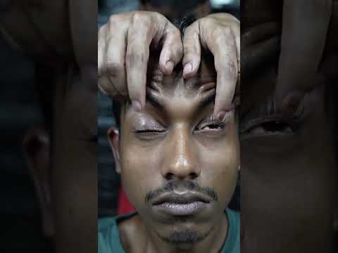 Migrain And Headache Relief Massage ASMR #shorts