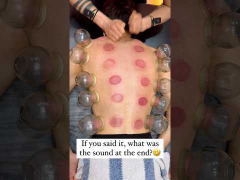 #shorts #cupping
