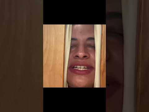 Face Cam Under the Table Captures Patient’s Reactions to Being Adjusted #shorts