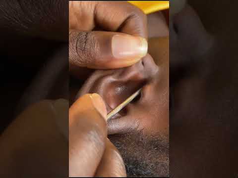 ASMR TO HELP YOU SLEEP, SLEEP TRIGGERS FOR SLEEP EAR PICKING AND CLEANING #earcleaning #nitpicking