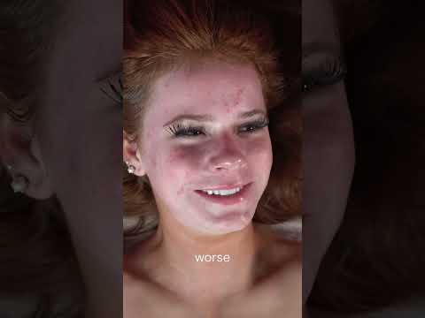 Shocking Face Scraping: What's REALLY on Your Skin?! #shorts