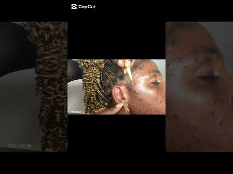ASMR SATISFYING EAR CLEANING AND NITPICKING WITH GUM CHEWING FOR THOSE WHO NEED SLEEP NOW