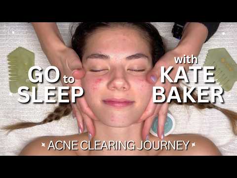 Fall Asleep to ASMR Facials 🌙 Kate Baker’s Acne Journey | No Talking