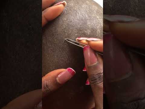 Dandruff Removal Asmr cranial nerve #tingling #satisfying #relaxing #nitpicking #asmrsounds