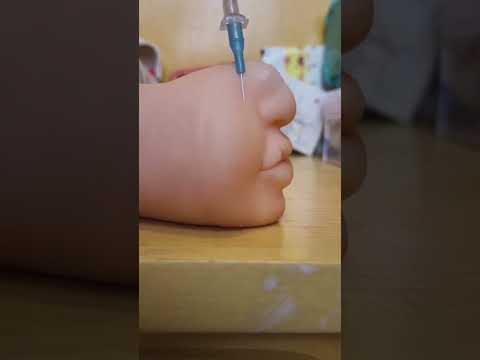 RINOPLASTIA ASMR #shorts