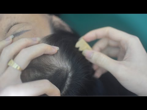 ASMR Head Scratching Real Person With Hair Sound ( Parting, Combing... ) For Stress Relief