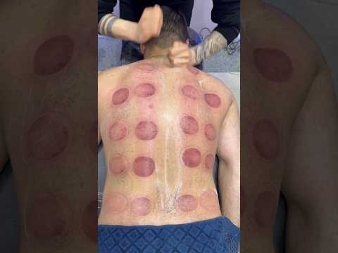 pizza peperoni 😍🍕#cupping #cuppingtherapy #asmr #explore #shorts #pizza #fire #youtubeshorts