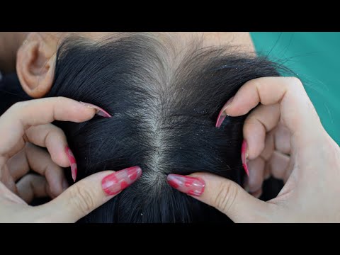 ASMR Scalp Check, Scalp Scratching, Scalp Massage For Better Sleep ( 1 Hour  + )