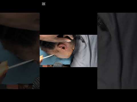 Ear cleaning and nitpicking for those who want to sleep immediately