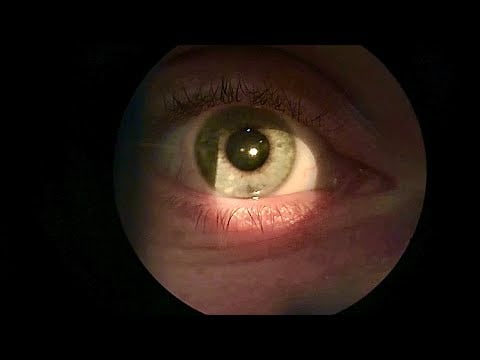 ASMR: Real Person Slit Lamp exam (Optometrist pov!)