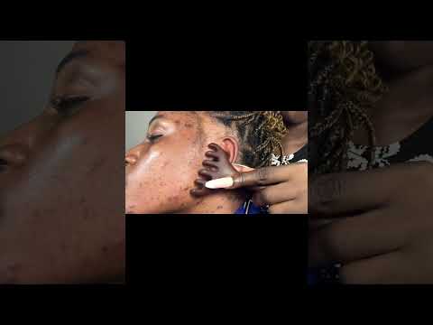 ASMR Ear Cleaning, Ear Eating, Ear Licking, Spit Painting, Ear Biting, Scalp Scratching For Sleep