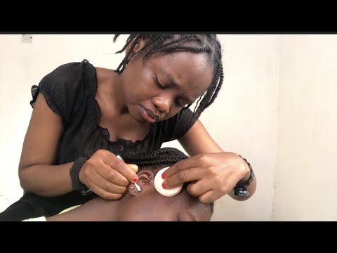 ASMR RELAXING EARCLEANING AND NITPICKING FOR THOSE WHO NEED TO SLEEP 😴 