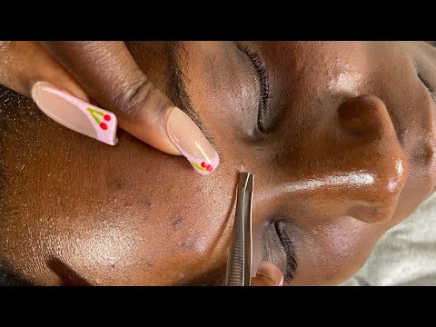 ASMR FACE CLEANING AND NITPICKING A LOT OF TINGLES