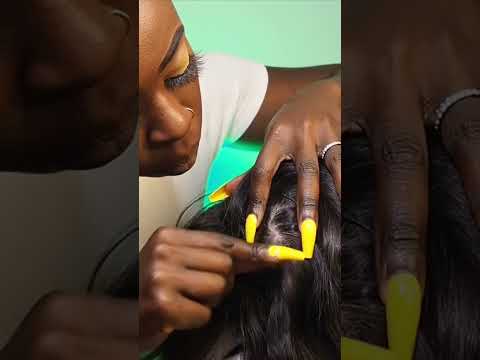 RARE & Sooo SATISFYING LiceScalp Checkup #foryou #foryoupage #fyp #explore #asmr #satisfying #capcut