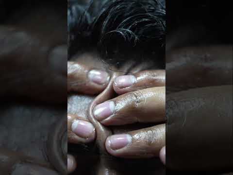 wow Amazing Forehead Tapping ASMR Head Massage #shorts