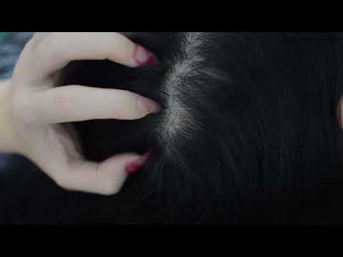 ASMR Scalp Check, Scalp Scratching Fast Make You Feel Stress Relief ( No Talking Asmr )