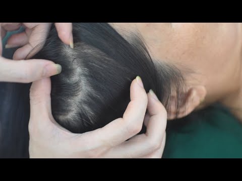 ASMR Nape Scratching Sounds , Real Person Scalp Scratch For Anxiety Relief