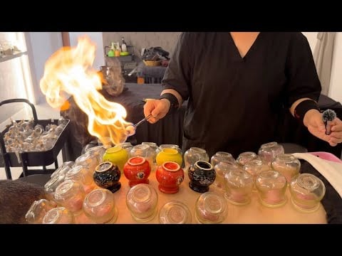 ASMR 🇻🇳 Only $4 Fire Cupping in Vietnam | Deep Relaxation | No Talking