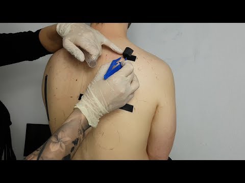 ASMR Back Allergy Testing, Check Up & Treatment