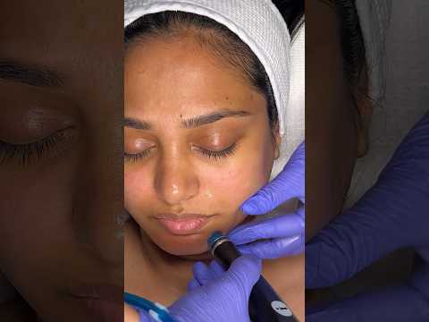 ASMR | Skin Goal HydraFacial is next level 😱😍