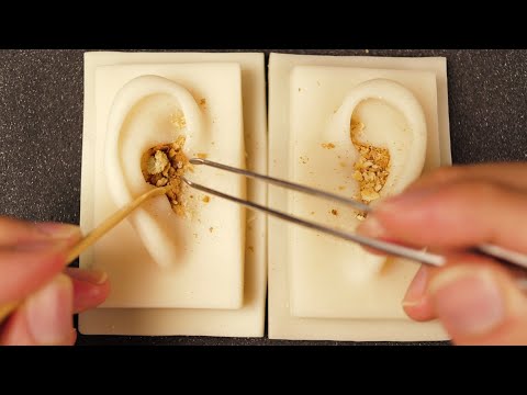 ASMR 👂Ear Cleaning (No Talking)