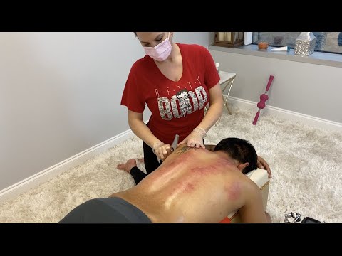 MASSIVE TOXIC RELEASE! Sounds of RAW BACK CRUNCHES, Skin Scraping, Rubbing, & Touch