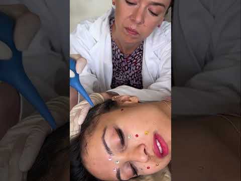 Asmr scalp tingles #asmr #asmrsounds #asmrvideo #relax #relaxing #satisfying #hair #sleep #tingles