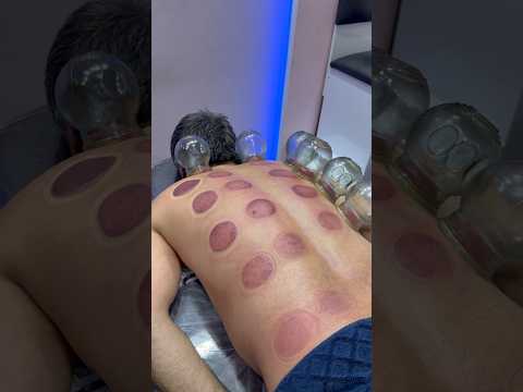 peperoni cupping😍😂#shorts #asmr #cupping #pizza #asmrsounds #cuppingtherapy