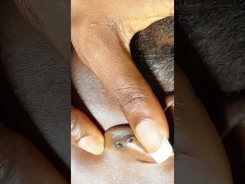 ASMR  deep ear cleaning #asmr #tingling #relax #tinglyfeeling #satisfying a lot of tingles