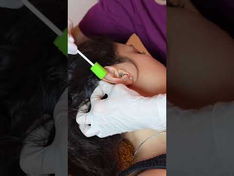 Asmr ear 👂 exam #asmr #relax #relaxing #asmrsounds #asmrvideo #tingles #medical #satisfying #sleep