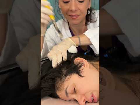 Asmr scalp tingles #asmr #asmrsounds #asmrvideo #relax #relaxing #satisfying #hair #sleep #tingles