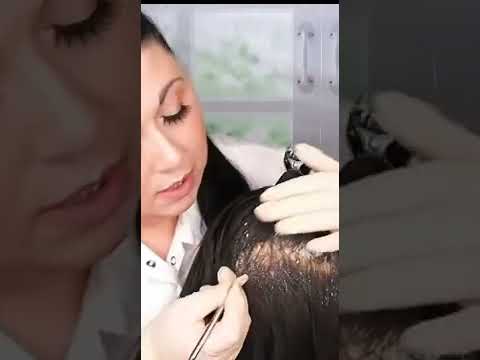 ASMR Scalp Check with Bad Results #shorts