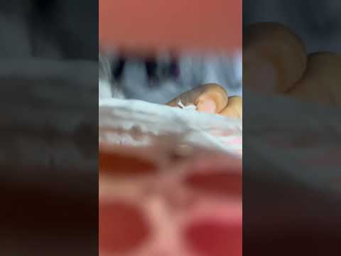 No pude salvar tu ojo 👁️ 🥺